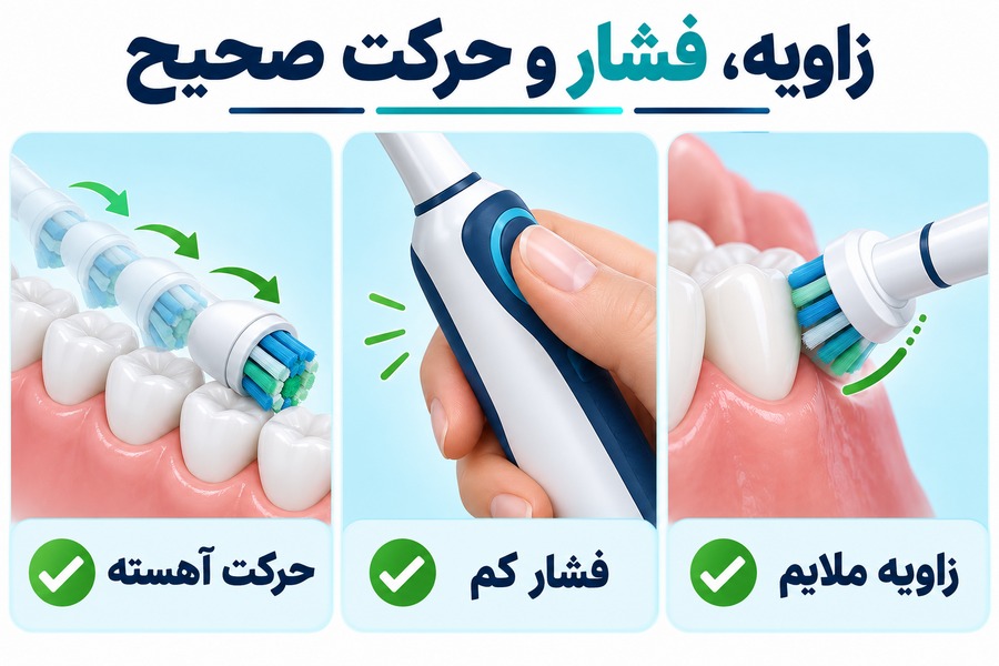 زاویه ملایم، فشار کم و حرکت آهسته برای استفاده صحیح از مسواک برقی روی دندان و خط لثه